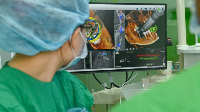 Slider image (5) Da Nang Implant Dental Clinic in Vietnam